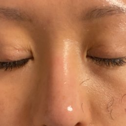 First morning after 2nd full set