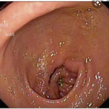 Levit Dermatology - How the healthy organ looks like - Dermatologists Near Me - Brooklyn, New York Levit Dermatology - How the healthy organ looks like - Dermatologists Near Me - Brooklyn, New York