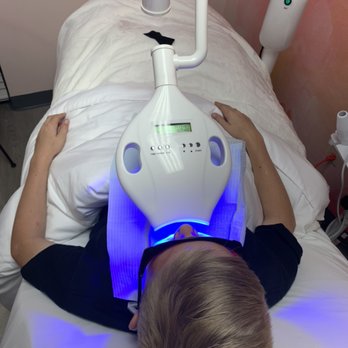 Skinfinite - Medical Grade Teeth Whitening, at s fraction of the cost Dentists charge! - Skin Care Near Me - San Diego, California Skinfinite - Medical Grade Teeth Whitening, at s fraction of the cost Dentists charge! - Skin Care Near Me - San Diego, California