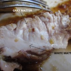Veal brains. I'm a med student, so the labels are 100% necessary.
