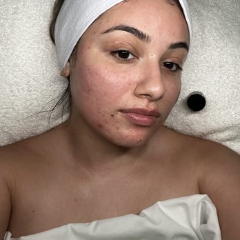 Beautify By Jazzy - Hydroglow facial service - Body Contouring Near Me - San Dimas, California Beautify By Jazzy - Hydroglow facial service - Body Contouring Near Me - San Dimas, California