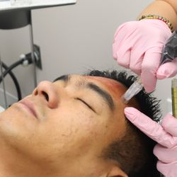 Noble Wellness and Aesthetics - Microneedling