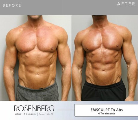 Body- Before and After - Individualized Care. Body- Before and After - Individualized Care.