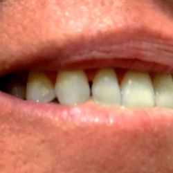 Busciglio Smiles Orthodontics & Pediatric Dentistry - Brandon