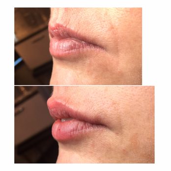 Posh Facial Esthetics - Medical Spas Near Me - Rochester, Minnesota Posh Facial Esthetics - Medical Spas Near Me - Rochester, Minnesota