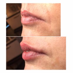 Posh Facial Esthetics