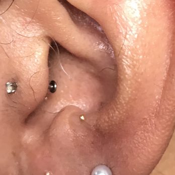 Redmint - Ear seeds are a form of ear acupuncture. Had three placed on each ear. - Acupuncture Near Me - San Francisco, California Redmint - Ear seeds are a form of ear acupuncture. Had three placed on each ear. - Acupuncture Near Me - San Francisco, California