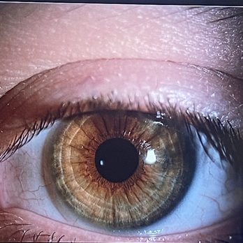 Clairemont Optometry - Got some super cool pictures of my eyes! - Optometrists Near Me - San Diego, California Clairemont Optometry - Got some super cool pictures of my eyes! - Optometrists Near Me - San Diego, California