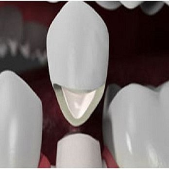 New Image Dental - General Dentistry Near Me - Fords, New Jersey New Image Dental - General Dentistry Near Me - Fords, New Jersey