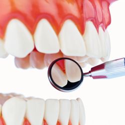 Burnaby Square Dental - dentist, gum graft, dentist burnaby, dentist new westminster, best dentist burnaby, invisalign burnaby, dental implants burnaby