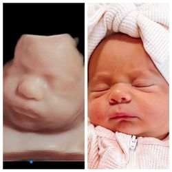 Little Peanut 4D Ultrasound