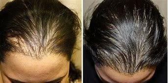 SELAH SKIN CARE & COSMETIC TATTOOING STUDIO - 10 Photos - Hair Loss
