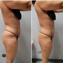 Photo of Body Bliss LV
