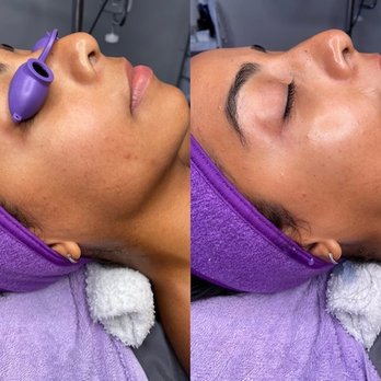 Amethyst Glow Studio - Check out our Glow Facial. It will keep you glowing. - Massage Therapy Near Me - Winter Park, Florida