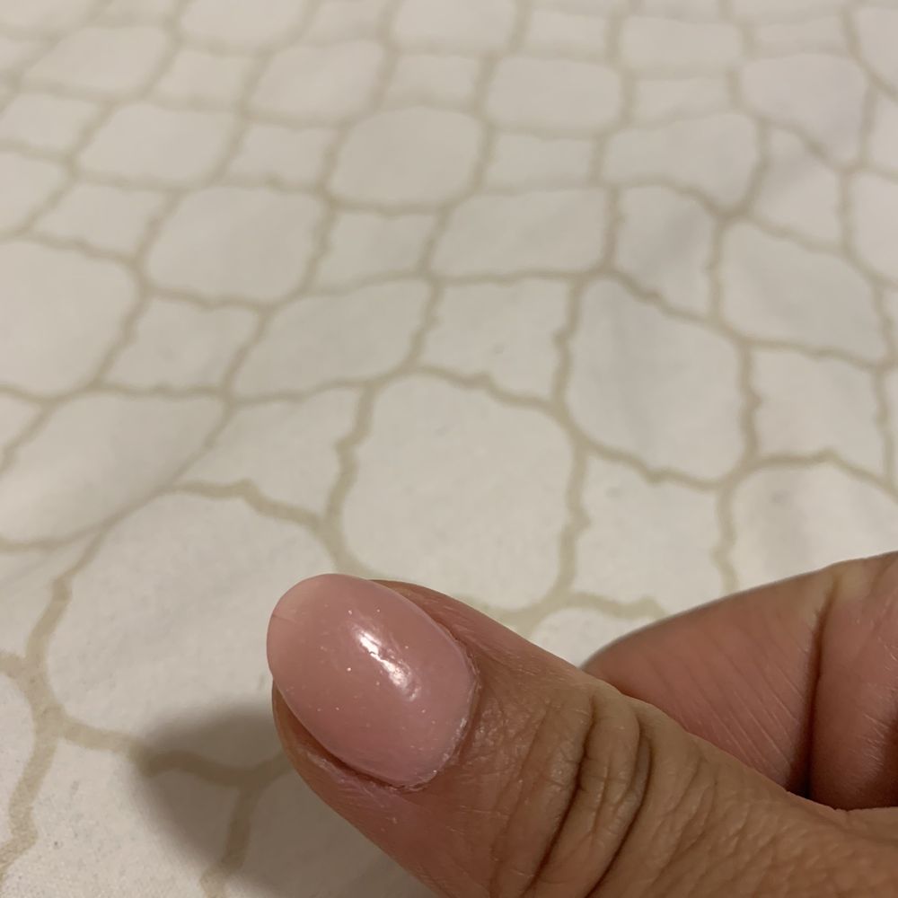 Spring Lily Nail Spa - Cracked thumb on the first day - Nail Salons Near Me - Forest Hills, New York Spring Lily Nail Spa - Cracked thumb on the first day - Nail Salons Near Me - Forest Hills, New York