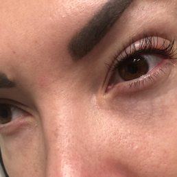 Bad eye reaction to whatever bad products they use. Lashes are not milk! They are think plastic Bad eye reaction to whatever bad products they use. Lashes are not milk! They are think plastic