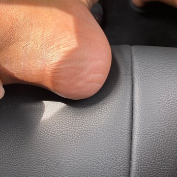 KNN Nails & Spa - Dry heels because of missed services. - Nail Salons Near Me - Lago Vista, Texas