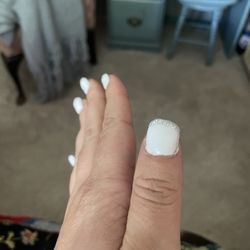 Crooked thumb