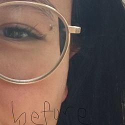 Chelsea Skin and Laser