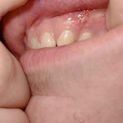 Providence Pediatric Dentistry