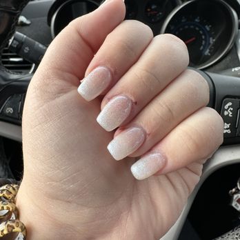 Red Design Nails - multiple cuts near cuticles - Nail Salons Near Me - Utica, Michigan Red Design Nails - multiple cuts near cuticles - Nail Salons Near Me - Utica, Michigan