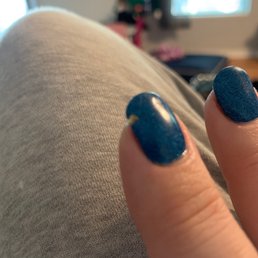 Picture of index finger, nails a week old, with a chunk of nail missing. Picture of index finger, nails a week old, with a chunk of nail missing.
