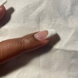 Lee Nails Spa - The cut that is cover with nail glue