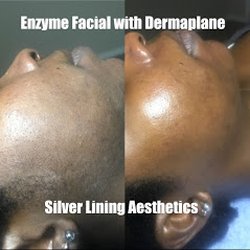 Dermaplane Facial