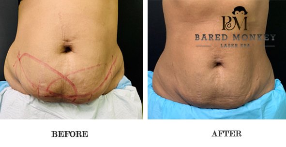 Bared Monkey Laser Spa by null