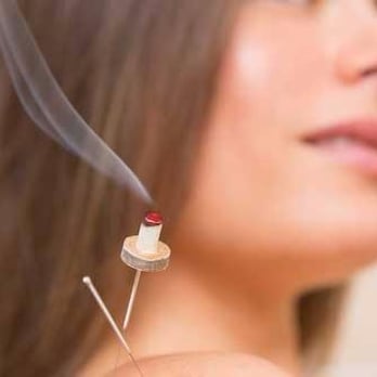 Accurate Acupuncture - Moxibustion - Traditional Chinese Medicine Near Me - Phoenix, Arizona Accurate Acupuncture - Moxibustion - Traditional Chinese Medicine Near Me - Phoenix, Arizona