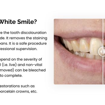 Modern White Smile - Teeth Whitening Near Me - Orlando, Florida Modern White Smile - Teeth Whitening Near Me - Orlando, Florida