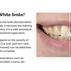 Modern White Smile