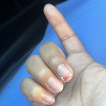 Golden Nail Spa - BEWARE OF NAIL ACRYLIC  REMOVER HERE - Nail Salons Near Me - Millbrae, California