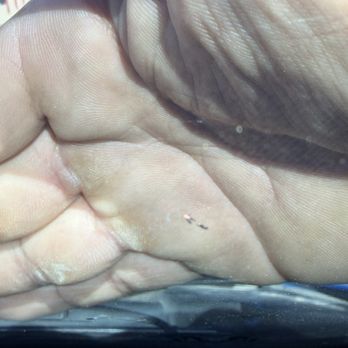 DECO Windshield Repair - These are the scratches that the technician left on my interior tint, using a metal tool - Windshield Installation & Repair Near Me - Edmonton, Alberta DECO Windshield Repair - These are the scratches that the technician left on my interior tint, using a metal tool - Windshield Installation & Repair Near Me - Edmonton, Alberta