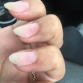 Nail Lounge & Spa - She purposely filed down my REAL nails when she was taking it all off. They are all uneven now. - Day Spas Near Me - Toronto, Ontario Nail Lounge & Spa - She purposely filed down my REAL nails when she was taking it all off. They are all uneven now. - Day Spas Near Me - Toronto, Ontario