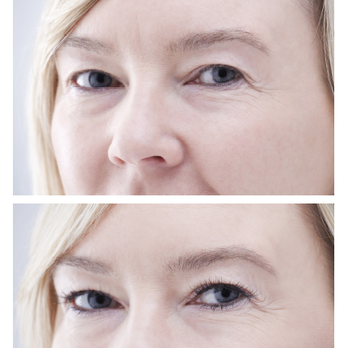 Bellevue - Eyelash Service Near Me - Dusseldorf, NW Bellevue - Eyelash Service Near Me - Dusseldorf, NW