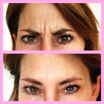 Regenerize Me - Skin Care Near Me - Northville, Michigan