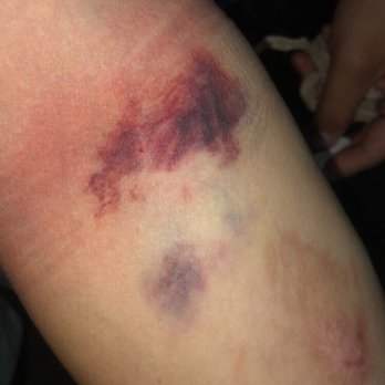 Grifols - Happen on site and wasn't even documented after Emma Fished and bubbled my vein and Irina Observed. - Blood & Plasma Donation Centers Near Me - Reseda, California Grifols - Happen on site and wasn't even documented after Emma Fished and bubbled my vein and Irina Observed. - Blood & Plasma Donation Centers Near Me - Reseda, California