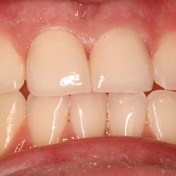 Joel A. Gentry, DDS - Cosmetic Dentistry