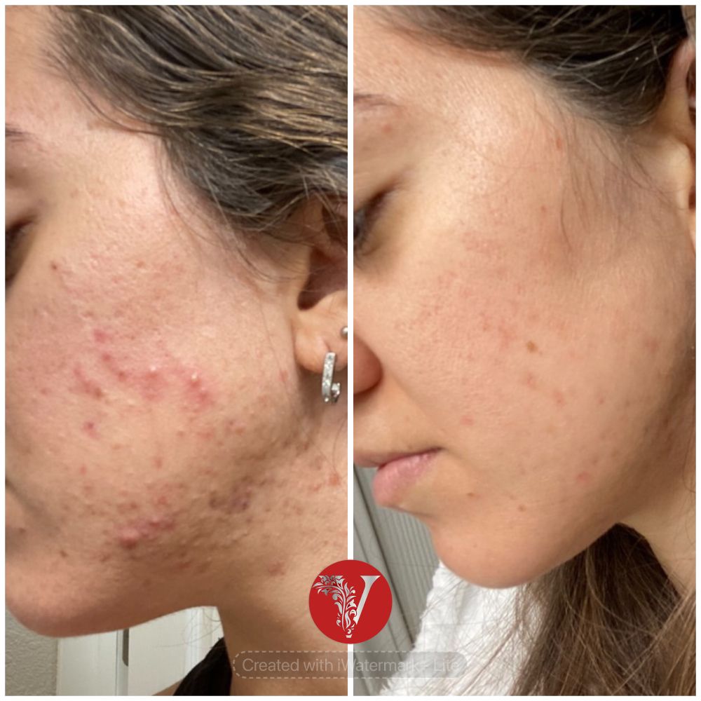 V Facial Beauty Logo