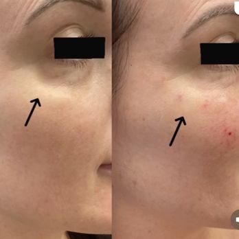 The Aesthetics Lab - Medical Spas Near Me - Las Vegas, Nevada The Aesthetics Lab - Medical Spas Near Me - Las Vegas, Nevada