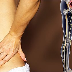 JP Chiropractic - Low Back Pain or Sciatica? We can help. Call JP Chiropractic today.