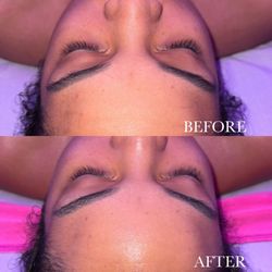 Nubia Skyn - Before & After Cloud 9 Facial Treatment