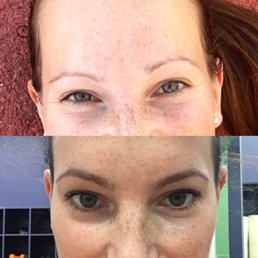 On top: eyebrows BEFORE in March 2016 On bottom: eyebrows AFTER in October 2016 No makeup used in both pictures On top: eyebrows BEFORE in March 2016 On bottom: eyebrows AFTER in October 2016 No makeup used in both pictures