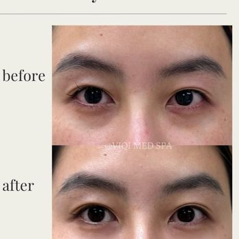 VIQI Med Spa - Medical Spas Near Me - Alhambra, California