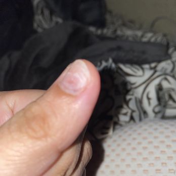 Lee Nails & Spa - The bruise in the button left hand corner of nail - Nail Salons Near Me - San Antonio, Texas Lee Nails & Spa - The bruise in the button left hand corner of nail - Nail Salons Near Me - San Antonio, Texas