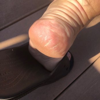D Luxe Nails - They didn't even bother to put oil or lotion on the heal after leaving the dead skin. - Nail Salons Near Me - Oak Lawn, Illinois D Luxe Nails - They didn't even bother to put oil or lotion on the heal after leaving the dead skin. - Nail Salons Near Me - Oak Lawn, Illinois