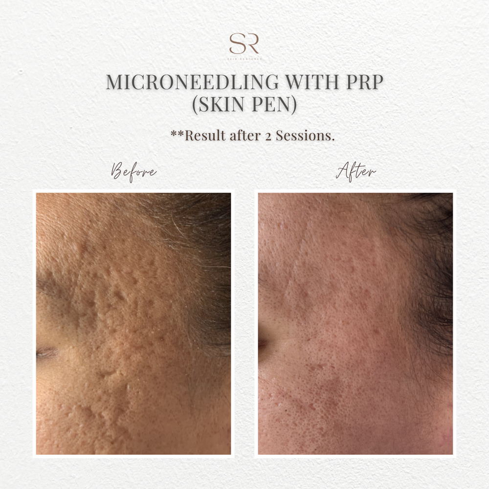 Top 61+ laser hair removal clovis ca best in.eteachers