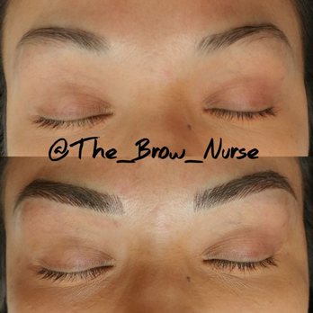 The Brow Nurse - Tattoo Removal Near Me - Redlands, California The Brow Nurse - Tattoo Removal Near Me - Redlands, California