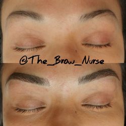 The Brow Nurse